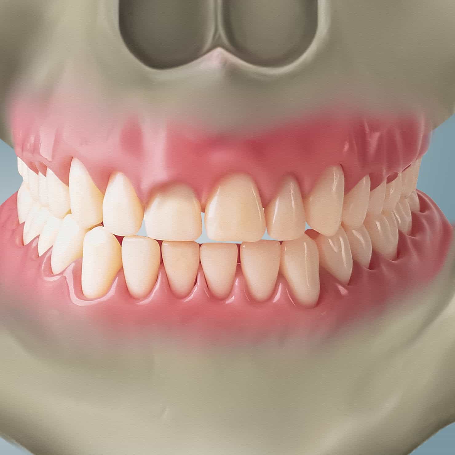 procedure
